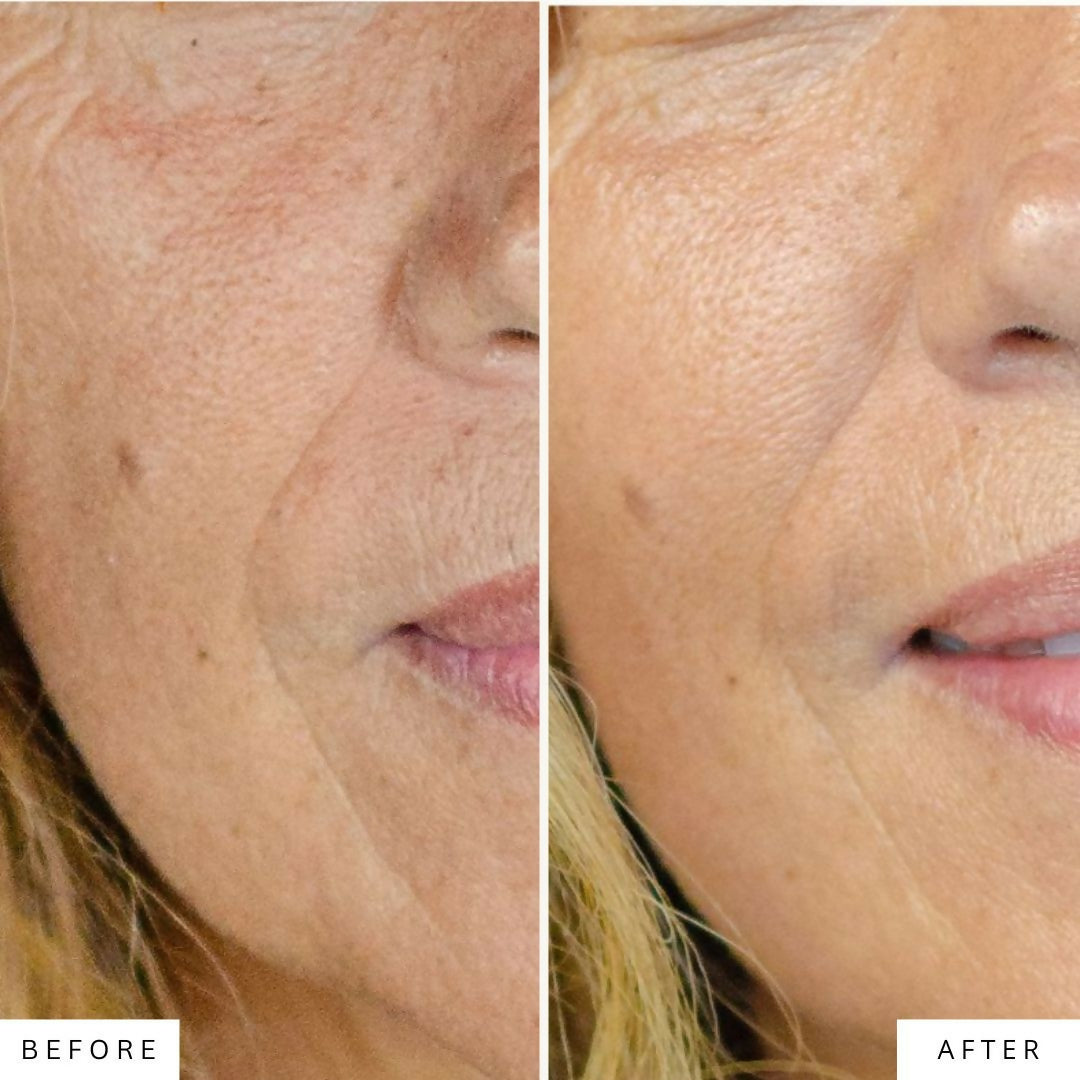 Rainforest Radiance Firming Peptide Cream